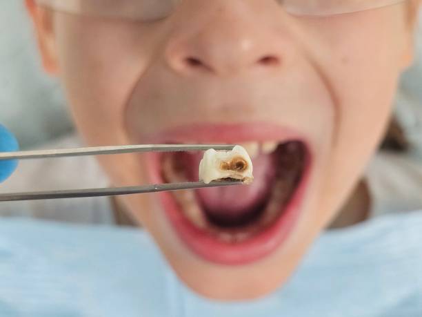 Best Emergency Cosmetic Dentistry (e.g., broken veneers) in San Martin, CA